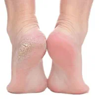 کف سابی وپارافین تراپی پا