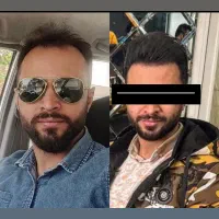 استخدام ویزیتور با پورسانت بالا در حوزه کاشت مو|استخدام بازاریابی و فروش|تهران, سعادت‌آباد|دیوار