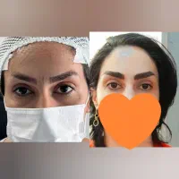 مدل کاشت ابرو دائمی