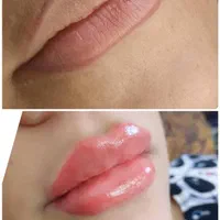 خدمات ژل و بوتاکس|خدمات آرایشگری و زیبایی|شیراز, نصرآباد|دیوار