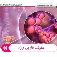 درمان طبیعی عفونت و سردی بدن بدون داروی شیمیایی|آرایشی، بهداشتی، درمانی|گنبد کاووس, |دیوار