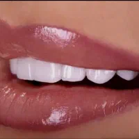 زیبایی دندان با لمینت و کامپوزیت شهررویان اقسا*ط