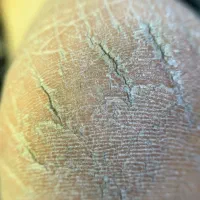 کاشت ناخن ، سالن زیبایی مهرآباد|خدمات آرایشگری و زیبایی|تهران, فتح|دیوار