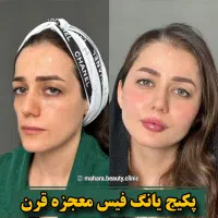 تخفیف یانگ فیس صورت ابرو پزشک پوست مو بینی زیبایی|خدمات آرایشگری و زیبایی|مشهد, هفت تیر (آب و برق)|دیوار