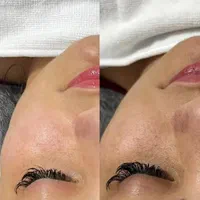 فیشال تخصصی و پاکسازی پوست صورت به همراه اموزش|خدمات آرایشگری و زیبایی|مشهد, کوی المهدی|دیوار