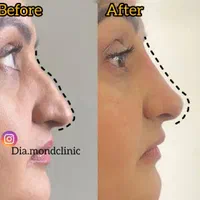 فیلر بوتاکس متخصص زیبایی|خدمات آرایشگری و زیبایی|تبریز, |دیوار