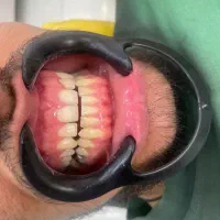 آموزش کامپوزیت ۹م و‌کلیه امور دندانپزشکی
