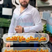 کاشت تخصصی مو هایا (با شرایط ویژه)