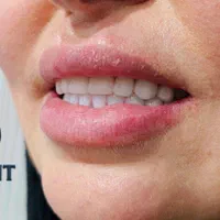 های دنت تخصصی ترین لابراتوار دندان مصنوعی(اقتصادی)|خدمات آرایشگری و زیبایی|گلستان (تهران), |دیوار