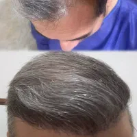 کاشت|خدمات آرایشگری و زیبایی|دورود, |دیوار