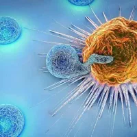 درمان زگیل و تبخال تناسلی