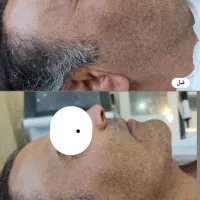 خدمات زیبایی پوست و مو در مطب دکتر شریفی|خدمات آرایشگری و زیبایی|فولادشهر, B5|دیوار