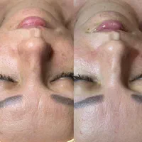 فیشیال تخصصی صورت و بدن تخفیف ویژه|خدمات آرایشگری و زیبایی|اصفهان, عسگریه|دیوار