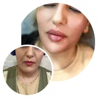 خدمات ژل و بوتاکس|خدمات آرایشگری و زیبایی|مشهد, سجاد شهر|دیوار