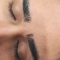 اصلاح صورت