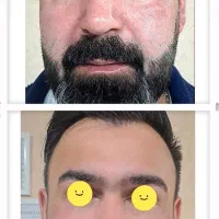 تجربه زیبایی واقعی با تکنولوژی پیشرفته Genix