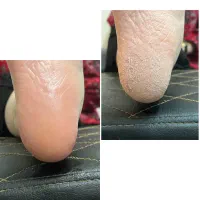 پاکسازی صورت/موژه/پدیکورپا(اموزش هم داده‌میشود)|خدمات آرایشگری و زیبایی|اهواز, شهرک رزمندگان|دیوار