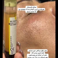 فیلر اقتصادی بوتاکس پیرسینگ|خدمات آرایشگری و زیبایی|ایرانشهر, |دیوار