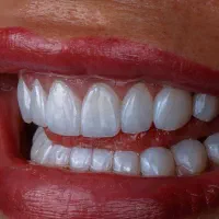 منشی مسلط به سوپروایزری دندانپزشکی ۴روز در هفته