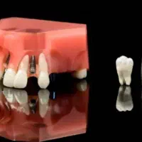 دندانپزشکی و دندان سازی خیریه چمران (جراحی. زیبایی|خدمات زیبایی و سلامت|تهران, امام حسین|دیوار