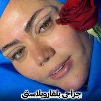 جشنوار بلفاروپلاستی-غبغب-بوکال فت-سانترال لب|خدمات آرایشگری و زیبایی|تهران, پاسداران|دیوار