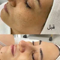 جشنواره تخفیفات ۵۰٪فشیال تخصصی (محدودتاجمعه)