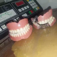 ساخت پروتز متحرک دندان/ دندان مصنوعی