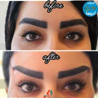 تخفیف ویژه خدمات پوست و مو به مناسبت روز  پزشک|خدمات آرایشگری و زیبایی|کرمانشاه, |دیوار