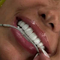 کامپوزیت با این کار خفن فقط فکی ۱۱ تومن مگه میشه