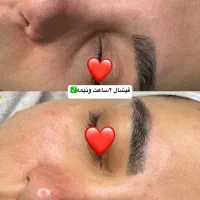 فیشال وپاکسازی پوست|خدمات آرایشگری و زیبایی|تهران, دردشت|دیوار