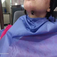 حجامت ،فصد ،زالو تراپی ،بادکش