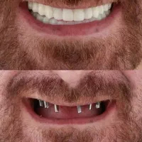 جشنواره دندانپزشکی اقساطی بلند مدت