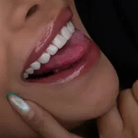 دندانپزشکی .کامپوزیت باقیمت ۱۴۰۴