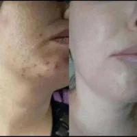 روشن کننده صورت و دست معجزه بشرط اصلی و گیاهی|آرایشی، بهداشتی، درمانی|یاسوج, |دیوار