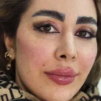 آف ویژه خدمات ژل و بوتاکس با بهترین قیمت700|خدمات زیبایی و سلامت|اهواز, کیان اباد|دیوار