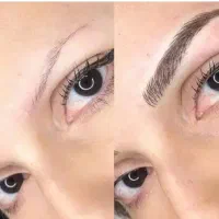 مدل برای فیبروز