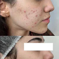 پوستت رو کره ای کل زیر قیمت کل تهران