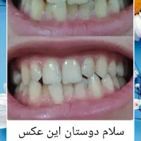 اسپری گیاهی درمانی|آرایشی، بهداشتی، درمانی|خوسف, |دیوار