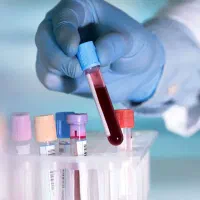 نیروی پذیرش و نمونه گیر خانم شیفت عصر