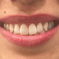 خدمات دندانپزشکی