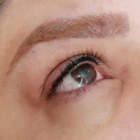 مدل برای فیبروز و خاویار تراپی|خدمات آرایشگری و زیبایی|اردبیل, |دیوار