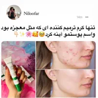 ضدجوش سالیسیلیک اسیدبیواکوا ولوازم دیگه|آرایشی، بهداشتی، درمانی|زاهدان, |دیوار