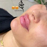 خدمات فیلر و بوتاکس|خدمات آرایشگری و زیبایی|خرمشهر, |دیوار