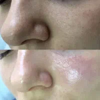 فشیال تخصصی و پاکسازی پوست در محیطی لوکس و آرام -|خدمات آرایشگری و زیبایی|قم, زنبیل آباد|دیوار