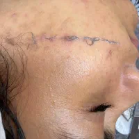 پاکسازی ۱۲مرحله با هدیه درما ۱۹۸ تومان( کلینیک)