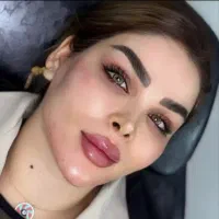 جشنواره زیبایی،تزریق ژل، بوتاکس ،پی ار پی ،هایفو