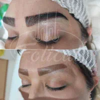 کاشت ابرو ۸میلیون|خدمات زیبایی و سلامت|تهران, نیاوران|دیوار