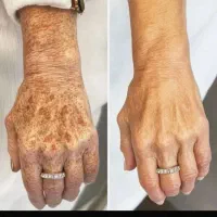 سفیدی تضمینی(بیوممتیک اورجینال)