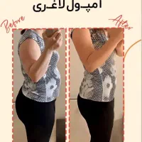 کاهش وزن ،با آمپول لاغری