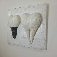 پاپیه ماشه دندان ایمپلنت|مجسمه، تندیس، ماکت|ارومیه, |دیوار